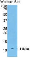 CXCL7/NAP-2 Antibody (12#)