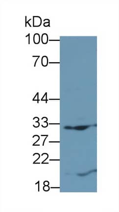 Flt-3 Ligand/FLT3L Antibody (D13)