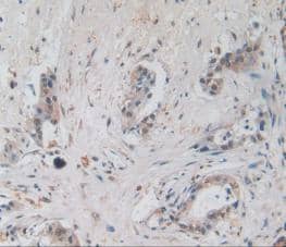 Amphiregulin Antibody (A3)