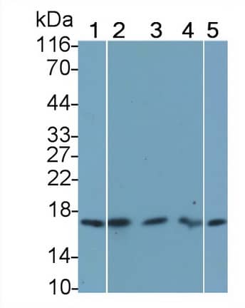 FGF acidic/FGF1 Antibody (C16)