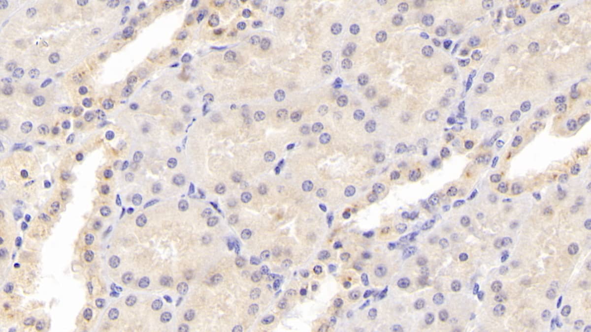 Osteoprotegerin/TNFRSF11B Antibody (C2)