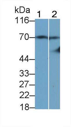 t-Plasminogen Activator/tPA Antibody (K17)