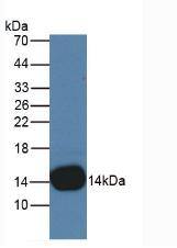 Cystatin B/Stefin B Antibody (C13)