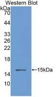 Cystatin B/Stefin B Antibody (C13)