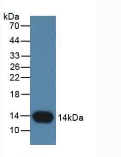 Cystatin B/Stefin B Antibody (C6)