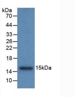 Cystatin B/Stefin B Antibody (C6)