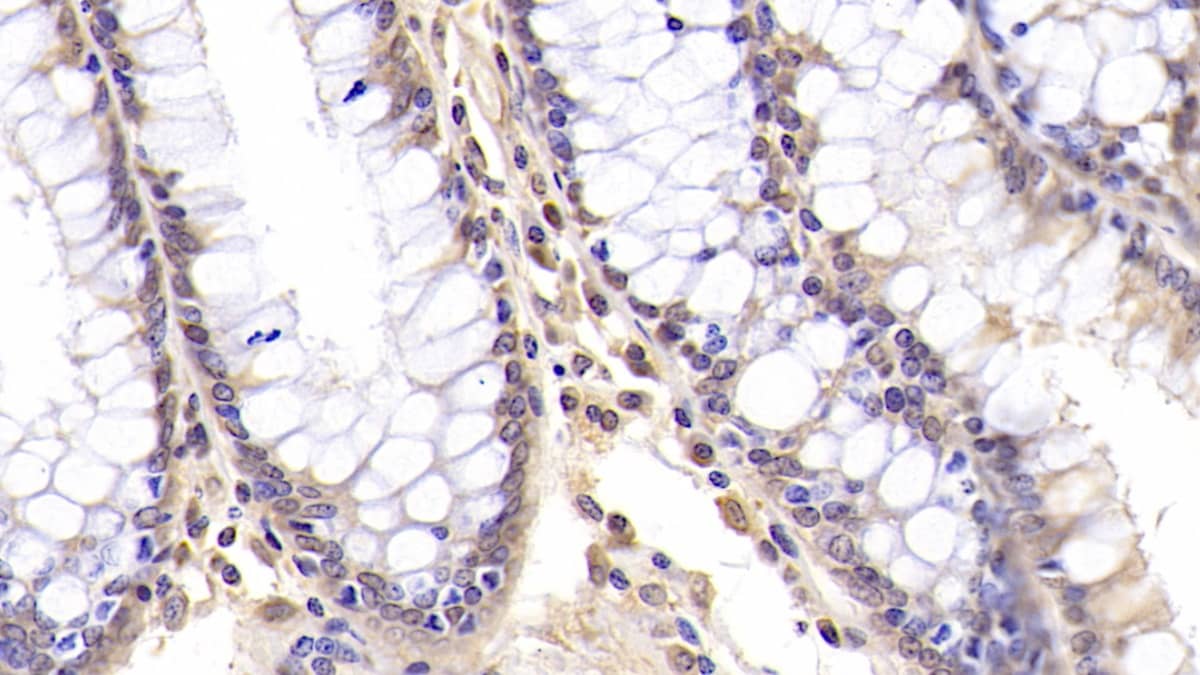 CD177 Antibody (C3)