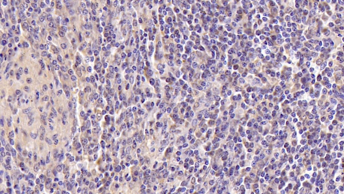 CD177 Antibody (C3)