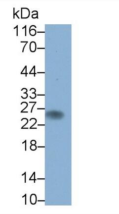 CD3 gamma Antibody (D14)