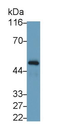 IFN-gamma R1/CD119 Antibody (C3)