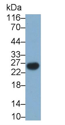 CD3 gamma Antibody (D13)