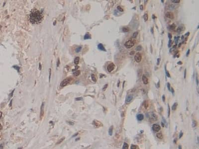 Amphiregulin Antibody (A7)