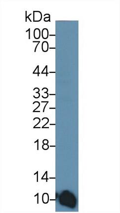 S100A6 Antibody (C2)