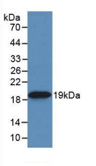 HSP20/HSPB6 Antibody (C9)
