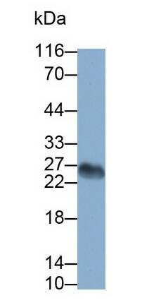 CD3 gamma Antibody (D12)