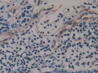 Amphiregulin Antibody (A2)