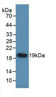HSP20/HSPB6 Antibody (C1)