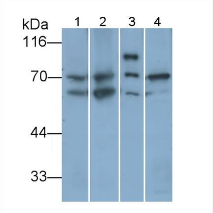 T Plastin Antibody (C14)