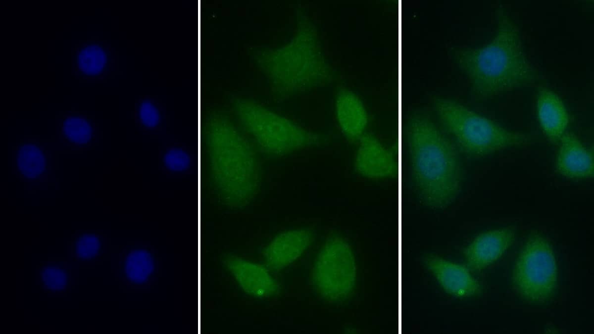 T Plastin Antibody (C5)