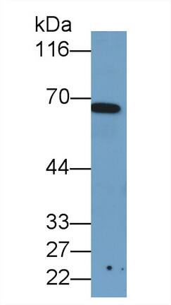 T Plastin Antibody (C5)