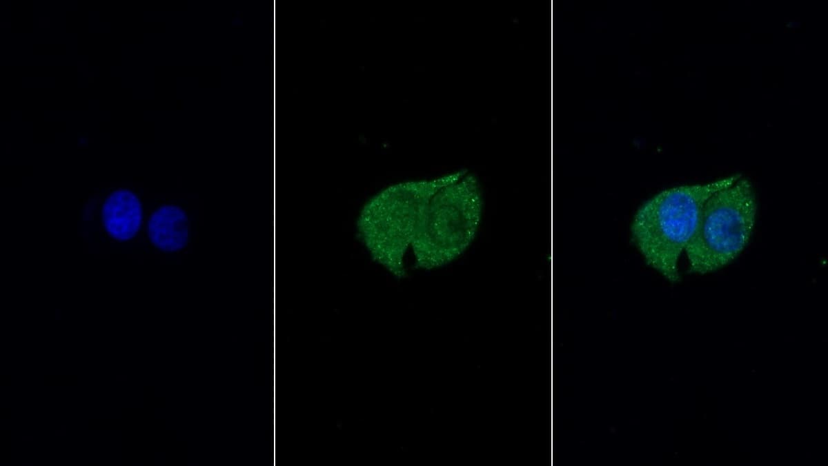 T Plastin Antibody (C10)