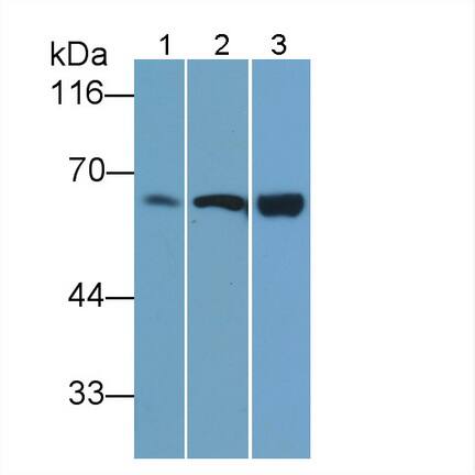 T Plastin Antibody (C10)