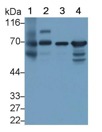 T Plastin Antibody (C2)