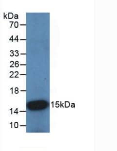 Cystatin B/Stefin B Antibody (C7)