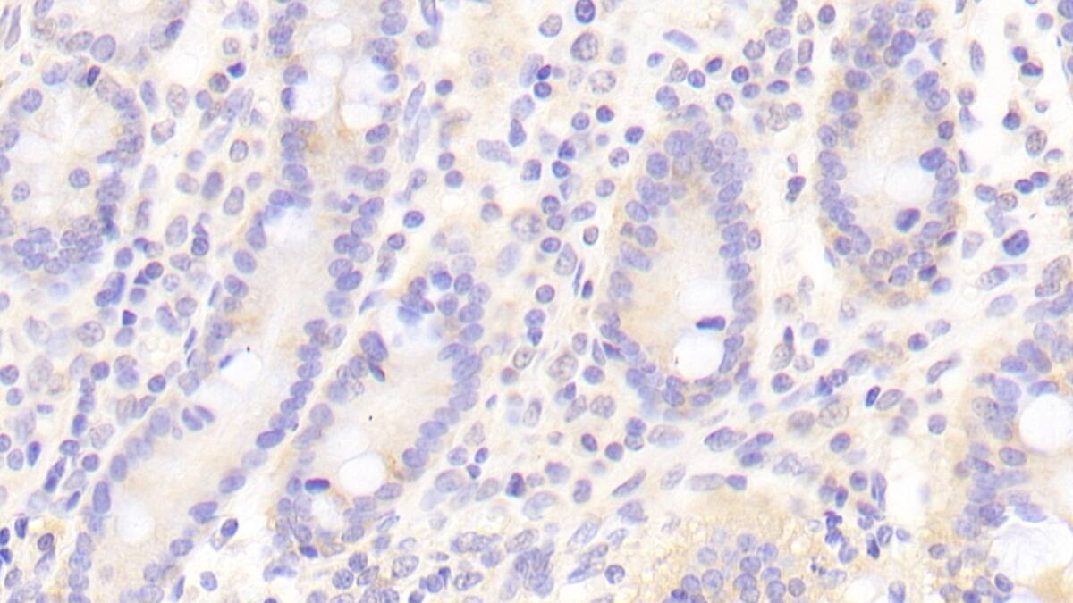 Fc gamma RIIIB/CD16b Antibody