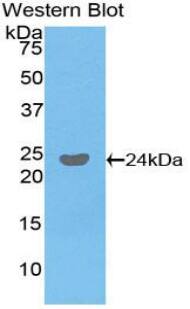 Fc gamma RIIIB/CD16b Antibody
