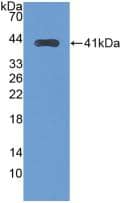 TfR2 Antibody (5#)