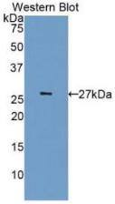 Cdk5 Antibody (3#)