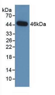 NEU-1/Sialidase-1 Antibody (2#)