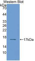 RBP2 Antibody (D2)