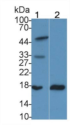RBP2 Antibody (D2)