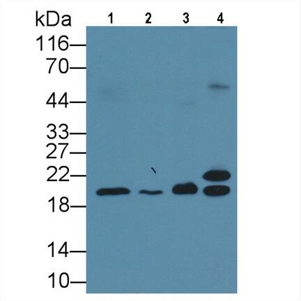 Muscarinic Acetylcholine Receptor M3/CHRM3 Antibody (C1)