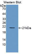 PDGF-BB Antibody (4#)