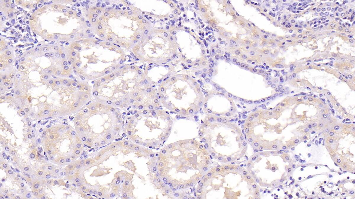 NT-3 Antibody (C3)