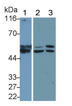 MMP-11 Antibody (5#)