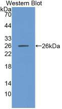 MMP-11 Antibody (5#)