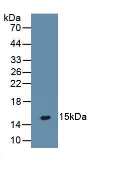 PTH2R Antibody (C1)