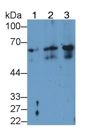 Cytokeratin 2 Antibody (D8)