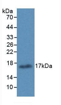 15-Lipoxygenase 1 Antibody (6#)