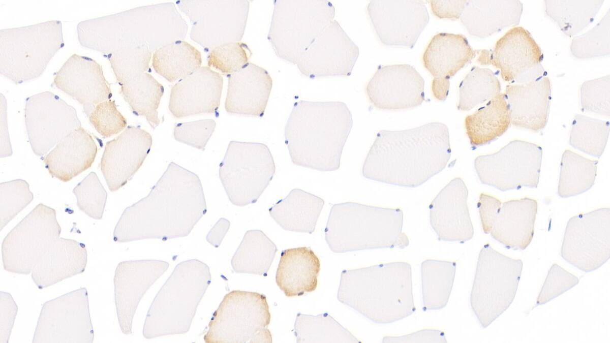 15-Lipoxygenase 1 Antibody (6#)