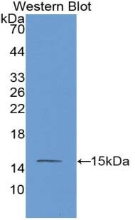 MASP2 Antibody (C9)