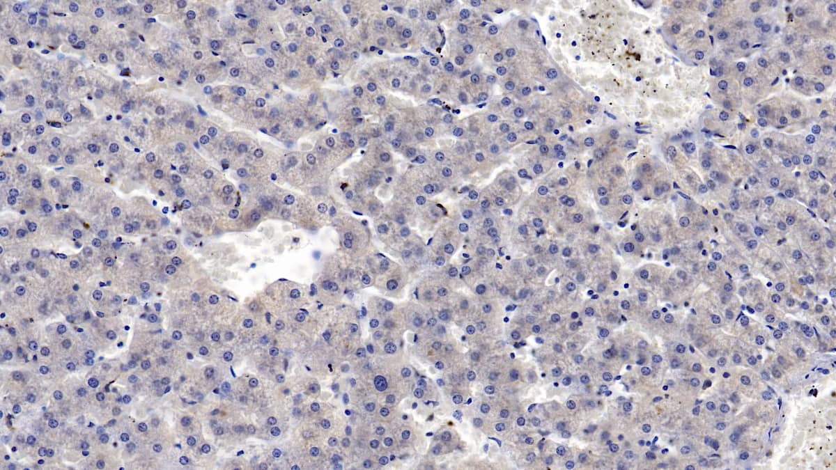 MASP2 Antibody (C9)