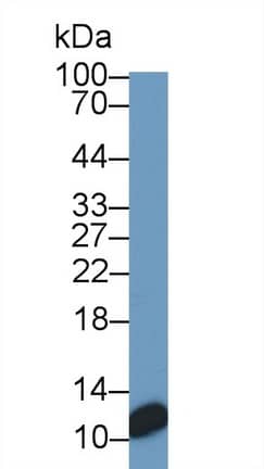 S100A/B Antibody (C8)