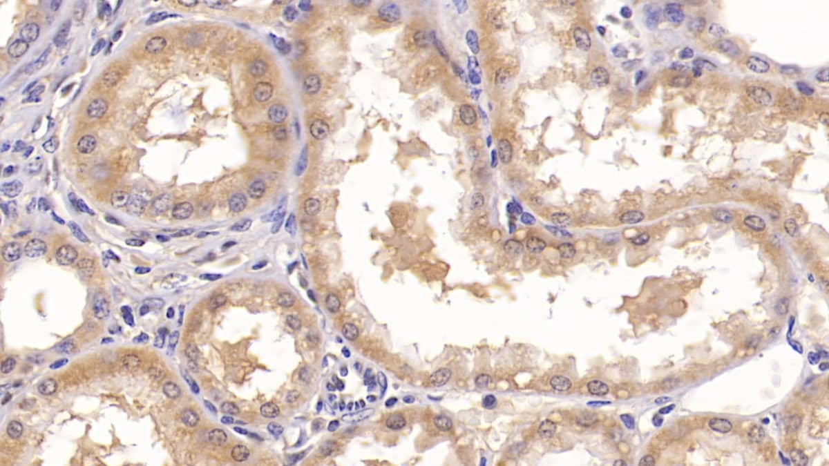 Annexin V Antibody (C10-1)