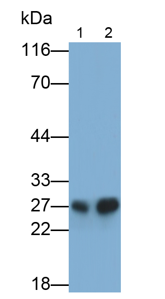 Cathepsin K Antibody (C1)