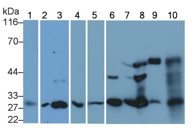 Cathepsin K Antibody (C1)